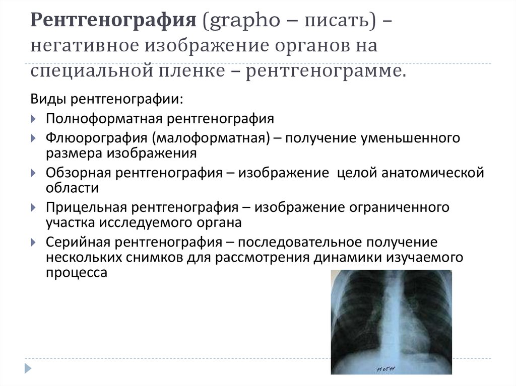 Интерпретация рентгеновского изображения является