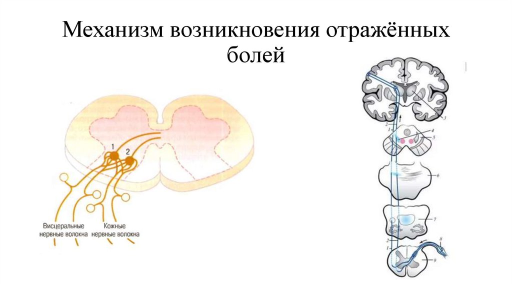 Зоны захарьина геда схема