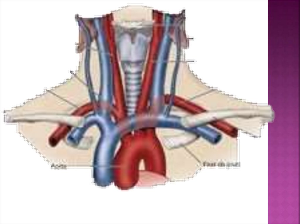 Левая подключичная вена. Подключичная артерия и Вена. Подключичная артерия и Вена анатомия. Подключичная Вена анатомия топография. Подключичная Вена Неттер.