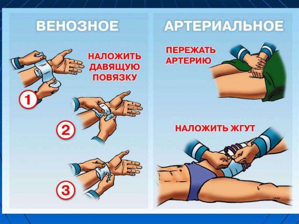 Первая доврачебная помощь при кровотечениях презентация