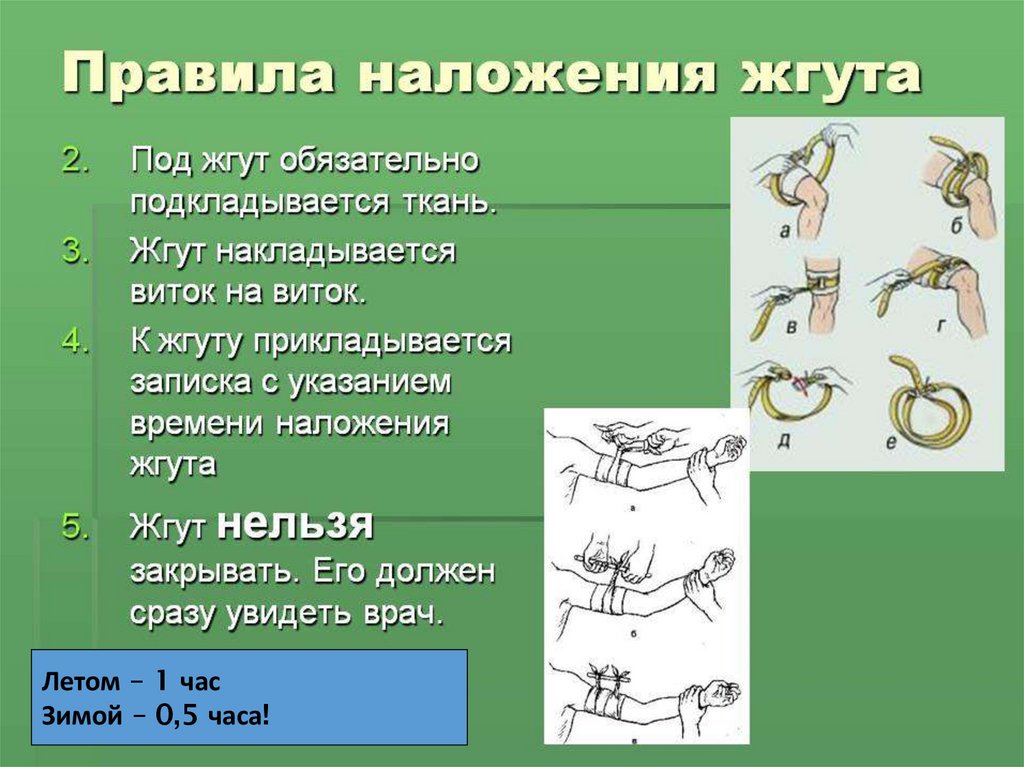 Время наложения жгута