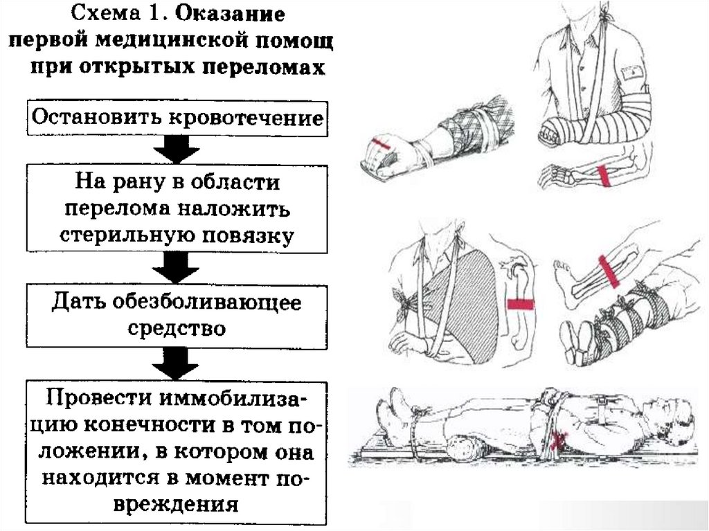 Первая помощь презентация для студентов