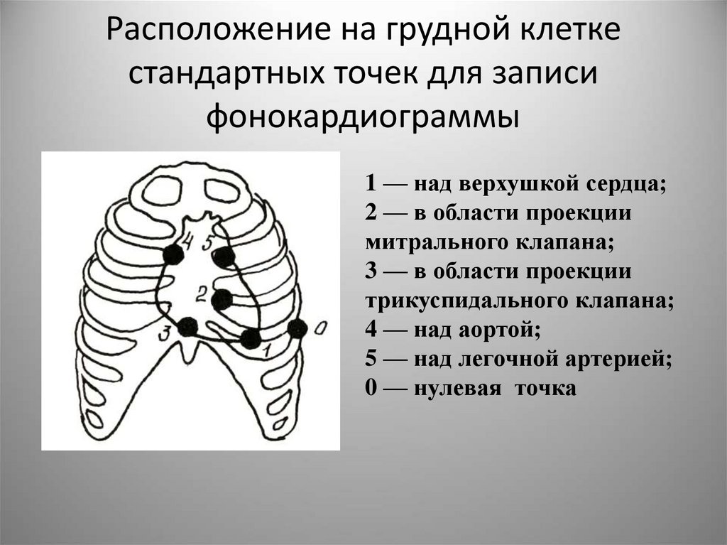 Расположение на грудной клетке стандартных точек для записи фонокардиограммы