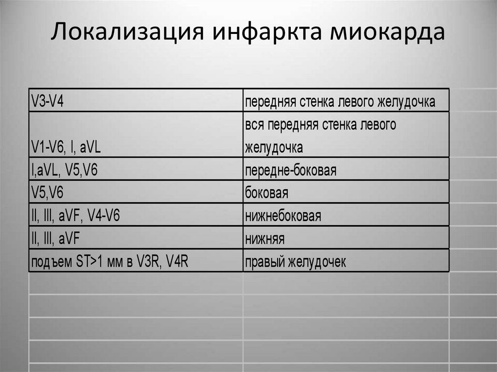 Локализация инфаркта миокарда