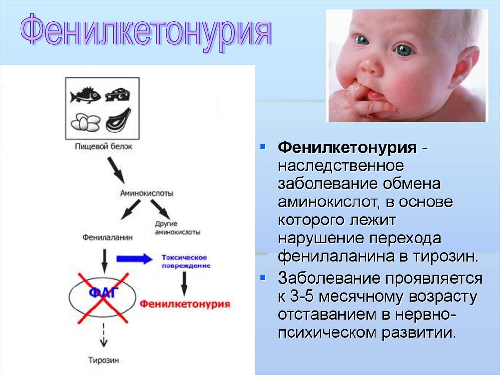 Фенилкетонурия генотип. Генные болезни фенилкетонурия. Фенилкетонурия симптомы Тип наследования. Фенилкетонурия характерные симптомы.