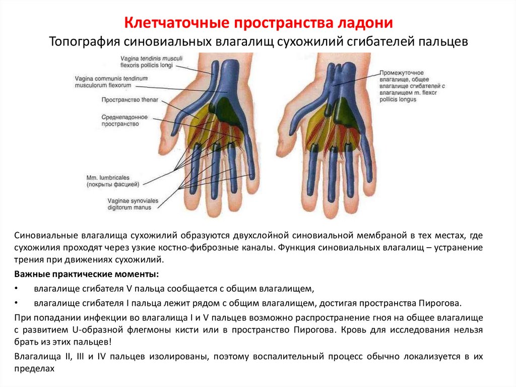 Клетчаточные пространства ладони Топография синовиальных влагалищ сухожилий сгибателей пальцев