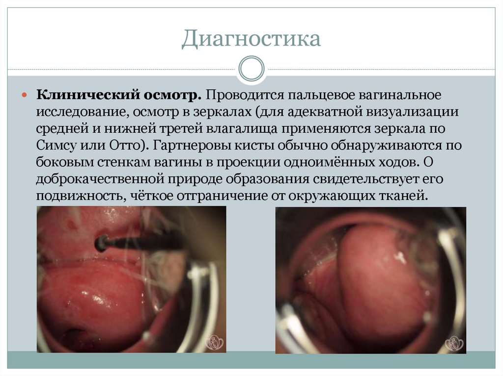 Диагностика