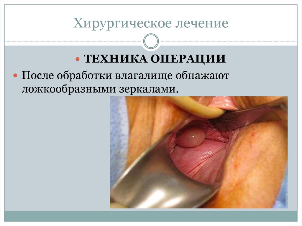 Хирургическое лечение