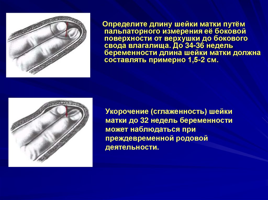 Длина шейк. Длина шейки матки как измеряют. Как узнать длину шейки матки. Как замеряют длину шейки матки.