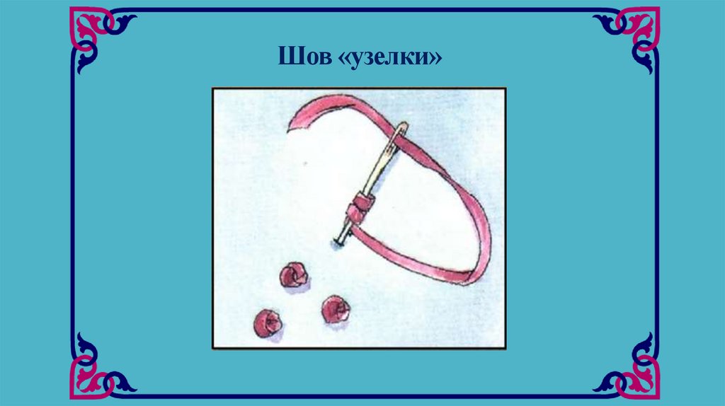 Шов «узелки»