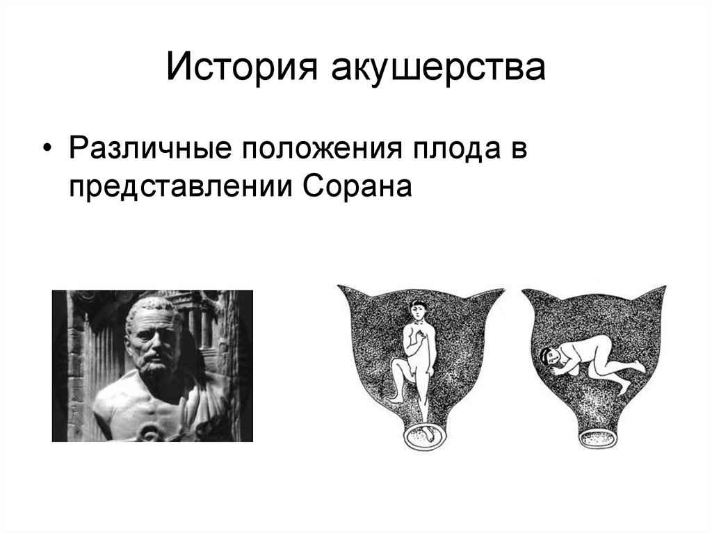 История акушерства презентация