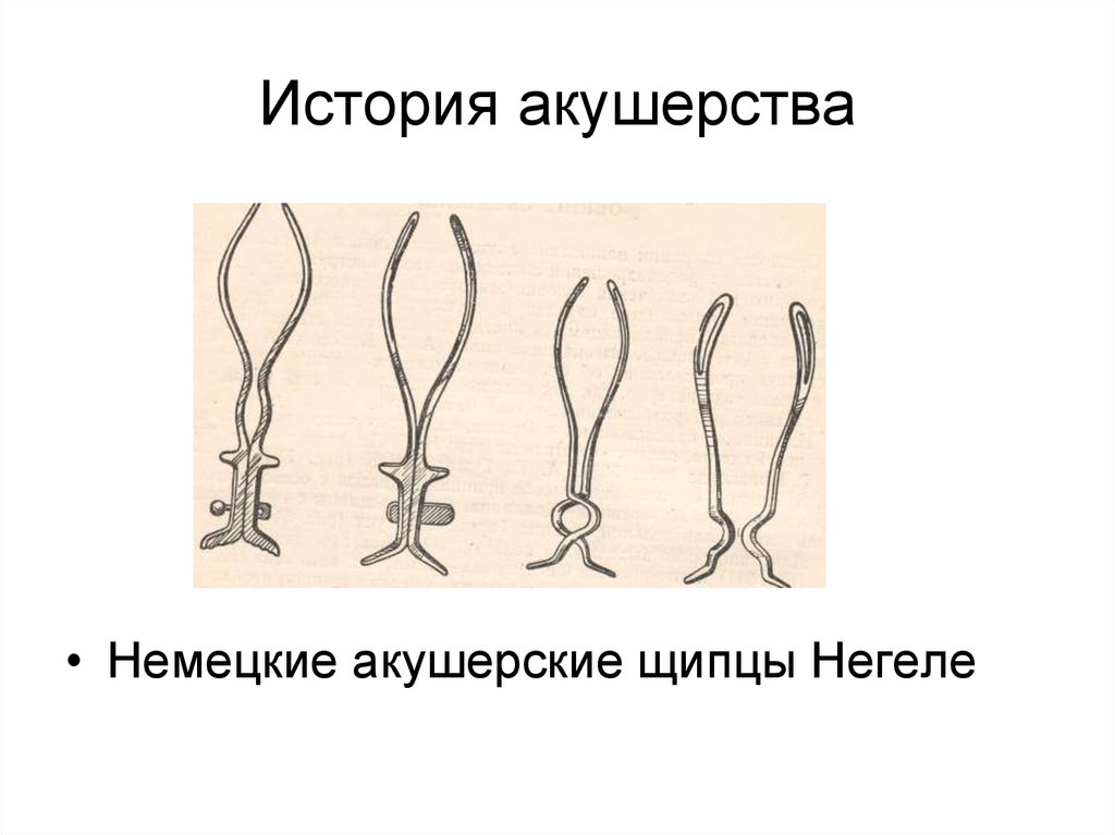 История акушерства презентация