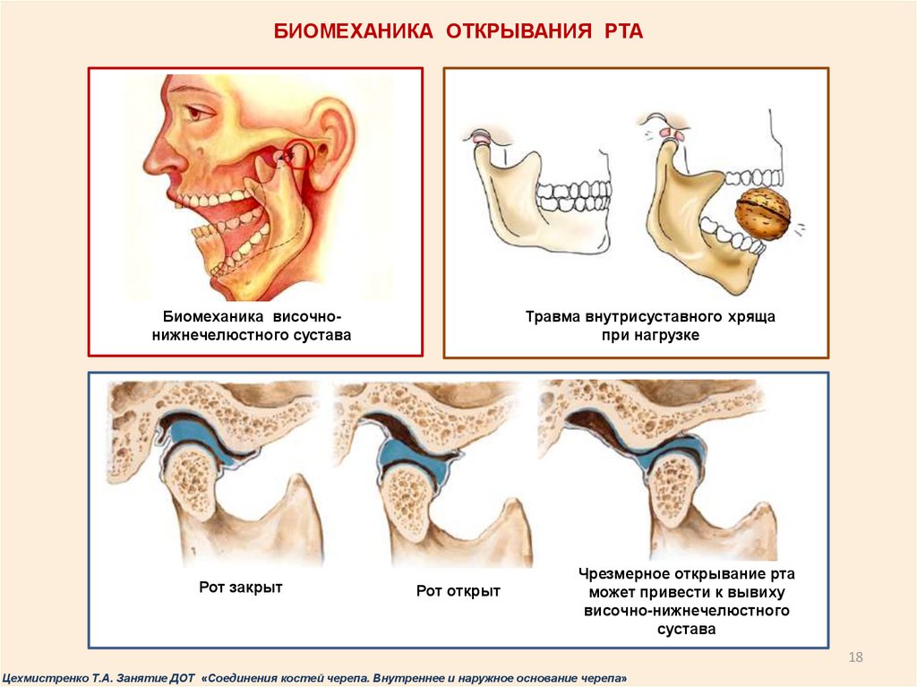 Вывих челюсти