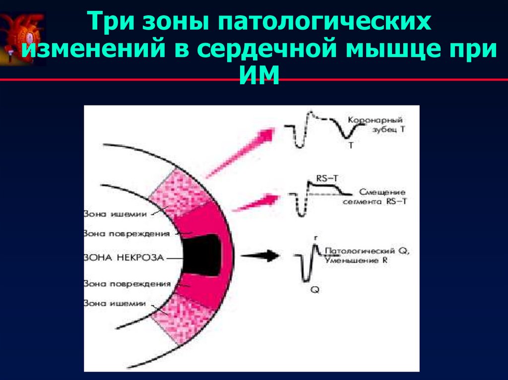 Зона окс