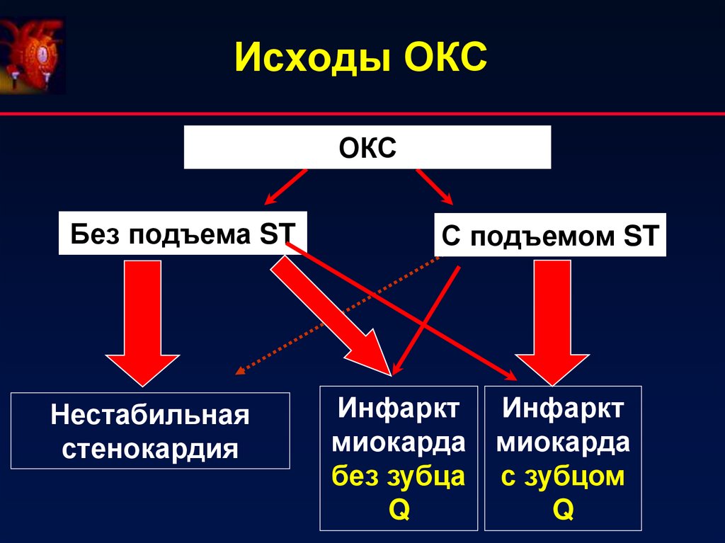 Презентация окс без подъема st