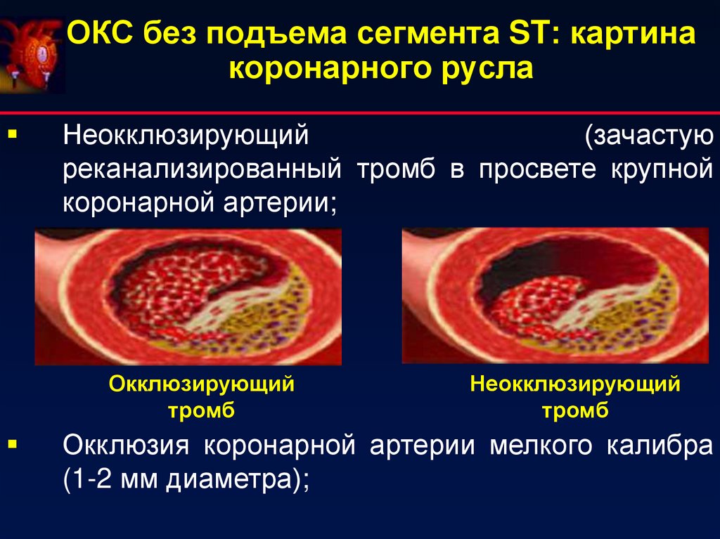 Окс картинки для презентации