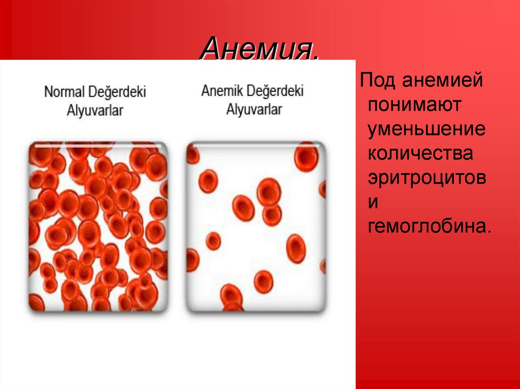 Цвет стула при анемии