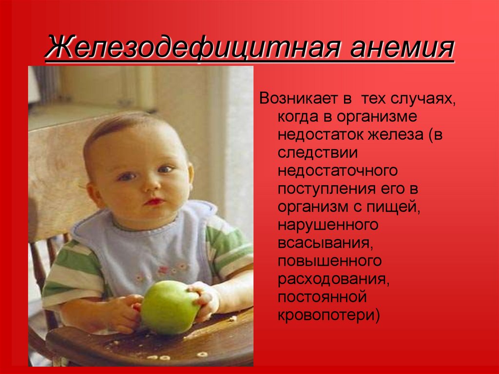 Железодефицитная анемия