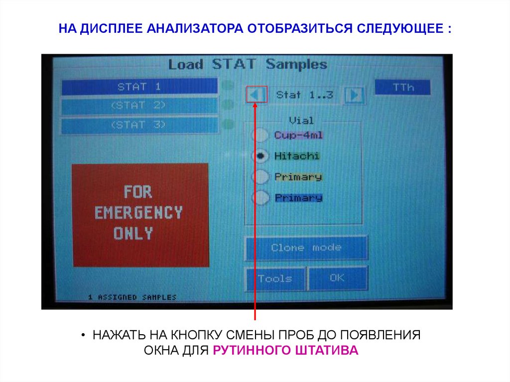 НА ДИСПЛЕЕ АНАЛИЗАТОРА ОТОБРАЗИТЬСЯ СЛЕДУЮЩЕЕ :