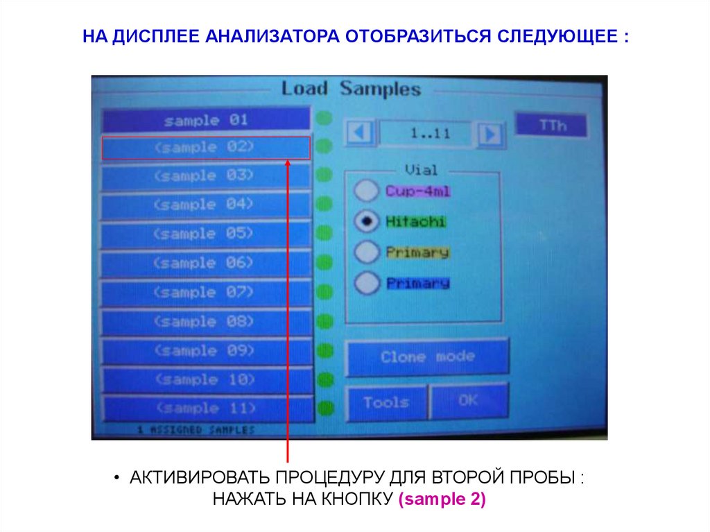НА ДИСПЛЕЕ АНАЛИЗАТОРА ОТОБРАЗИТЬСЯ СЛЕДУЮЩЕЕ :