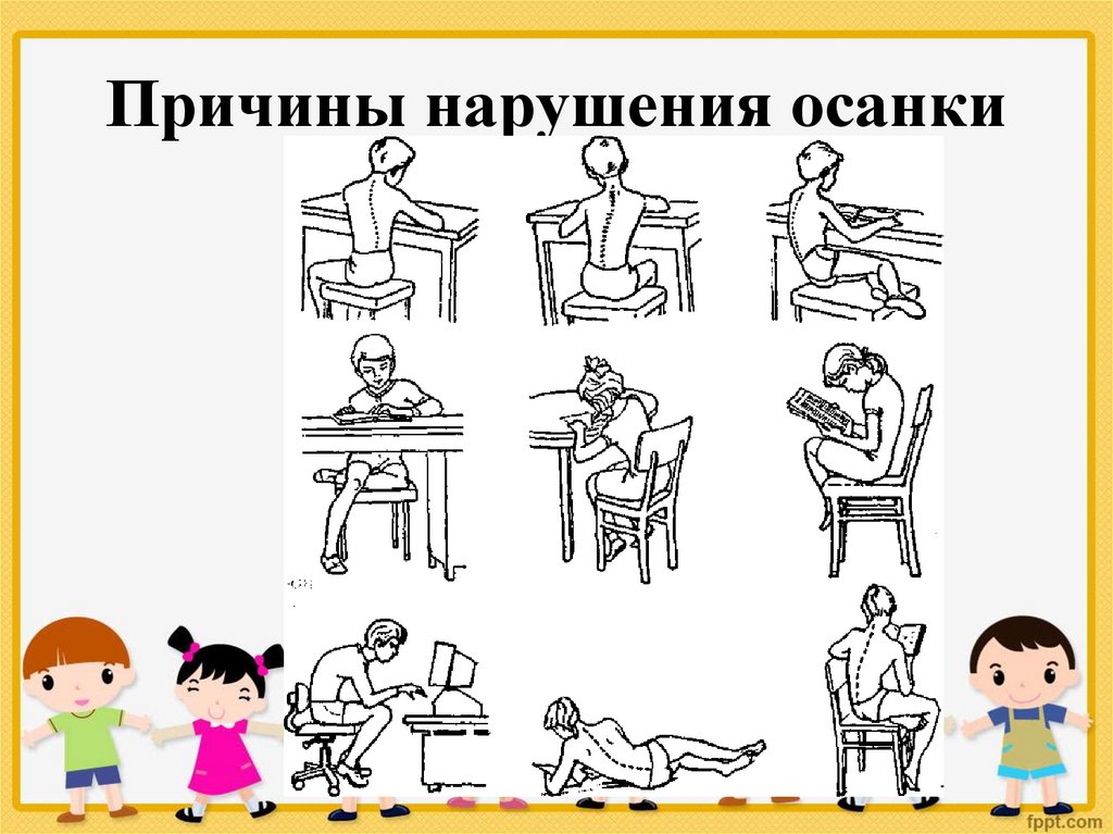 Каковы причины нарушения осанки