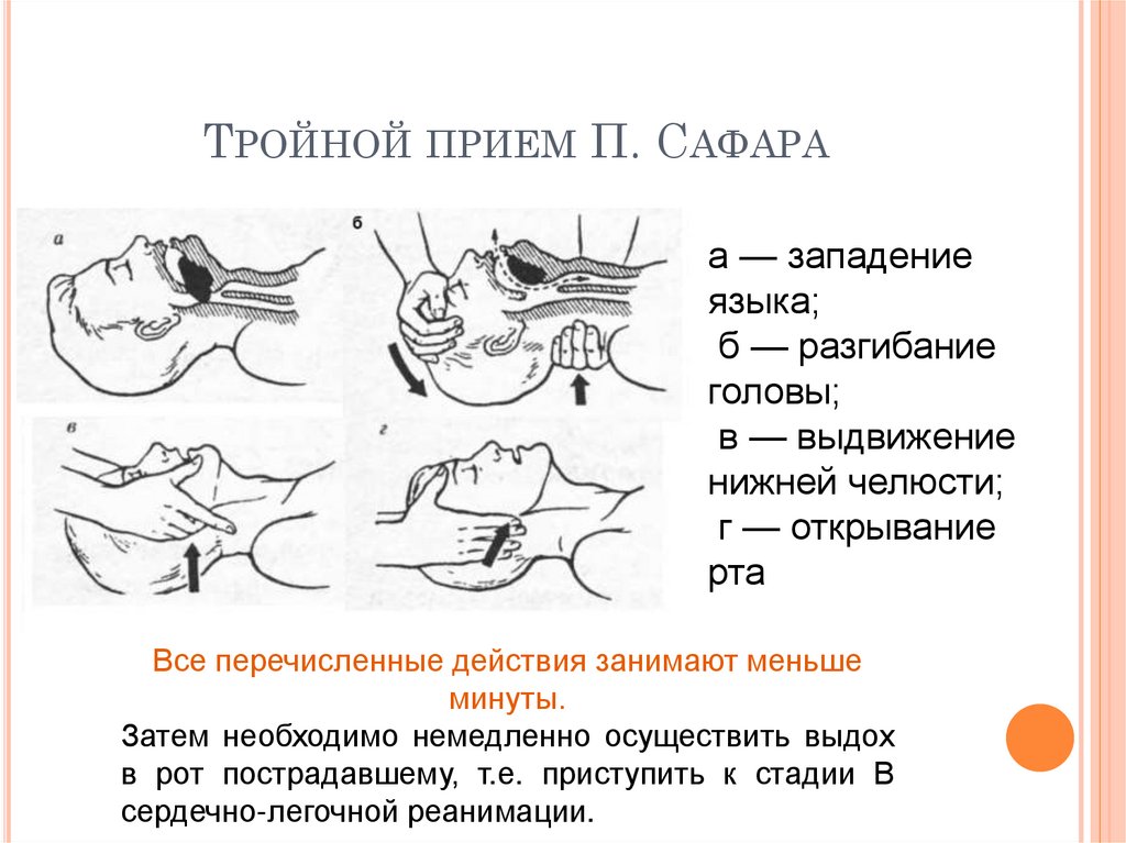 Тройной прием алгоритм