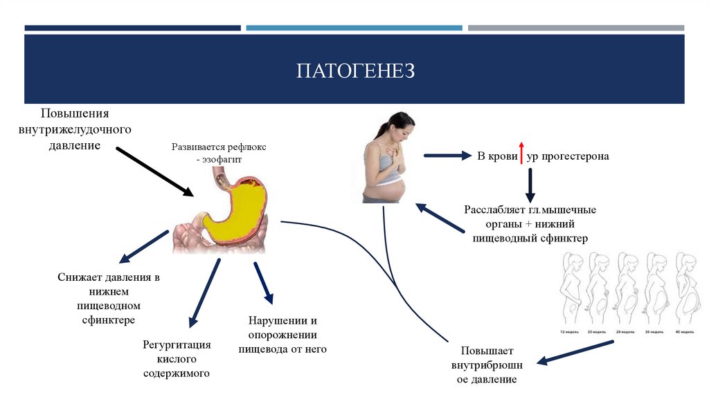 Давление после бани повышается. Снижение давления в Нижнем сфинктере пищевода. Снижают давление в Нижнем сфинктере пищевода продукты. Денол сниженное давление. Понижение давления патогенез.