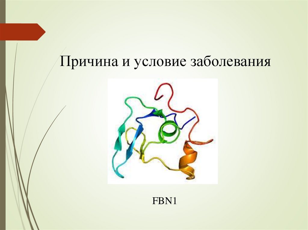 Синдром марфана презентация