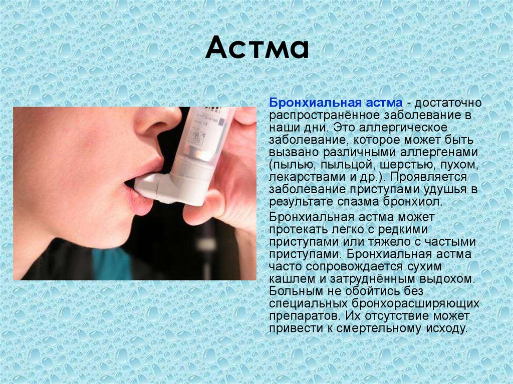 Врожденная астма. Астма. Бронхиальная астма. Болезнь бронхиальная астма.