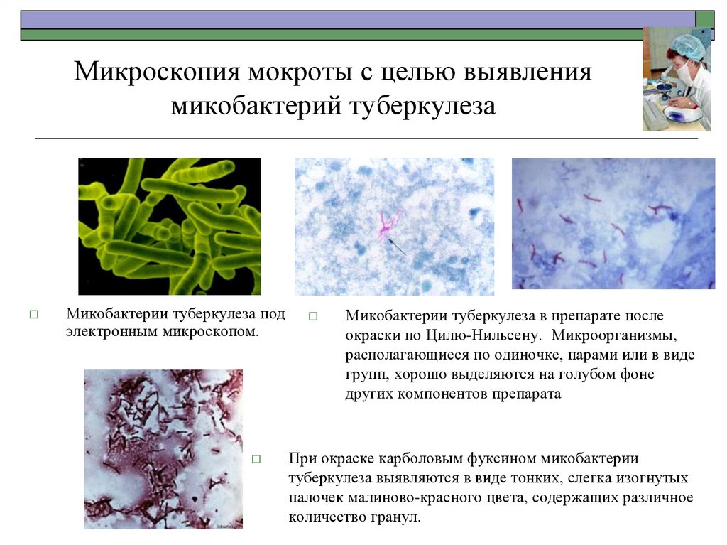 Микобактерии туберкулеза микроскопия мокроты.