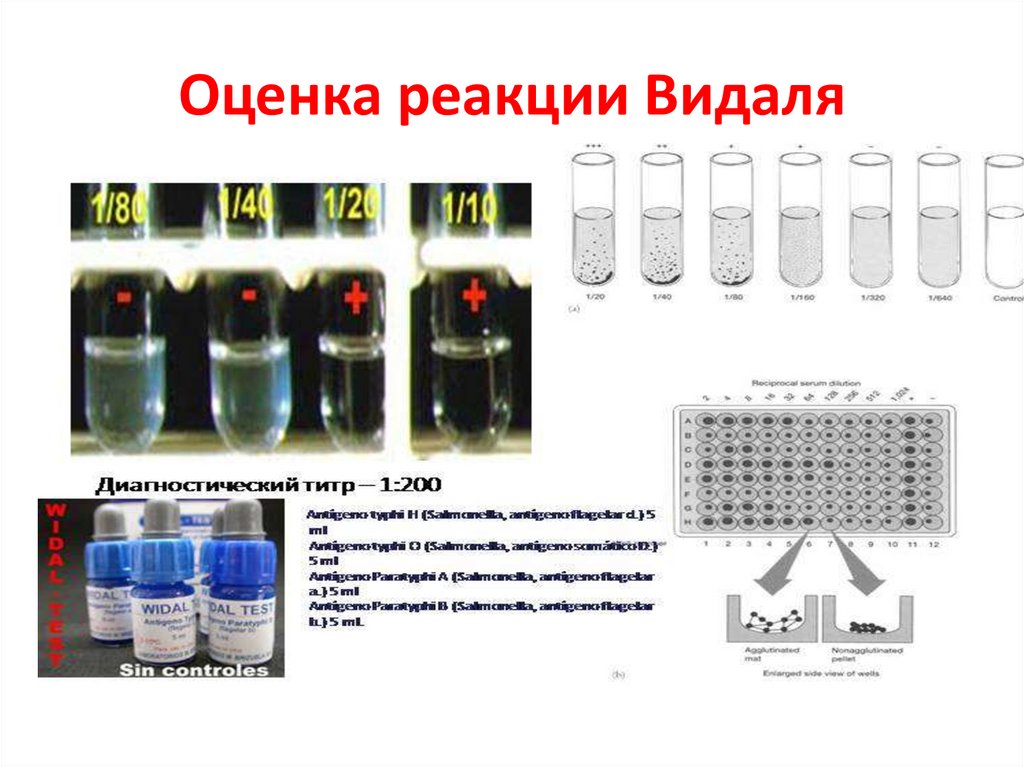 Оценка реакции Видаля