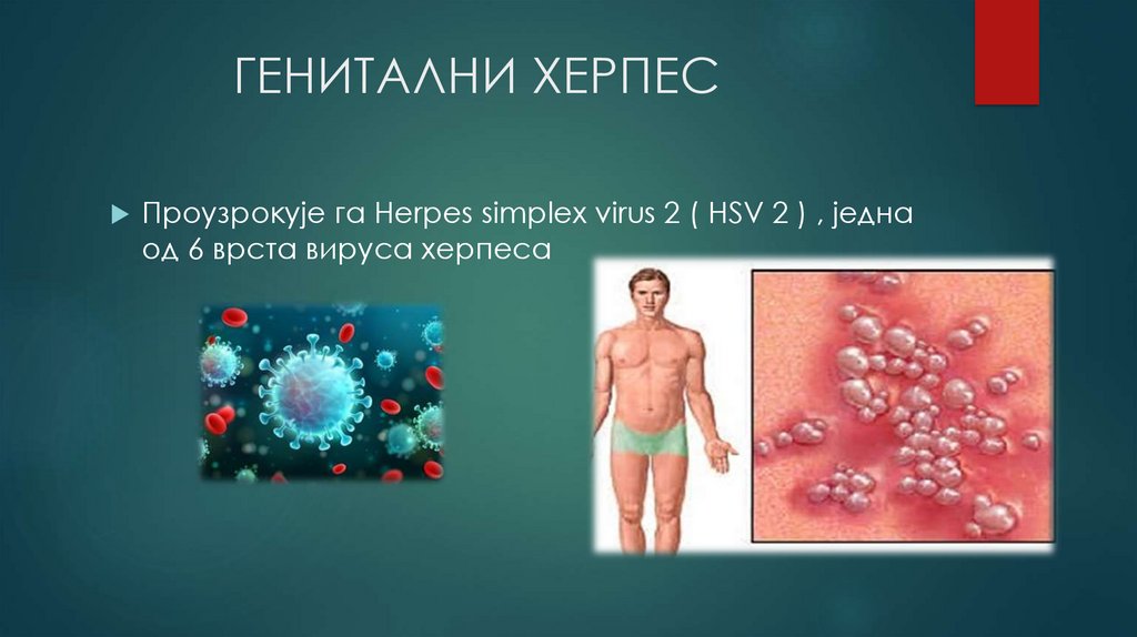             ГЕНИТАЛНИ ХЕРПЕС