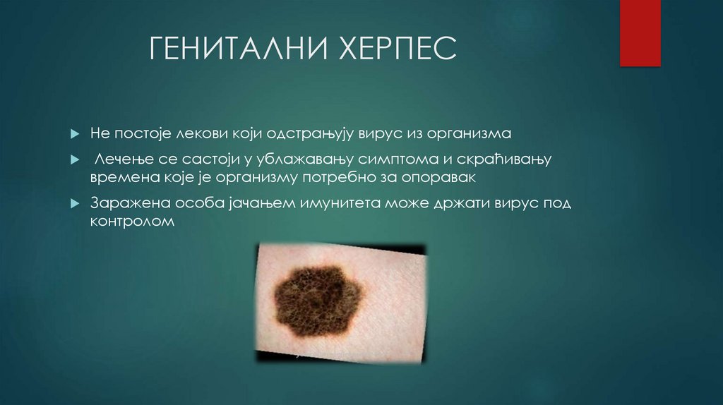             ГЕНИТАЛНИ ХЕРПЕС