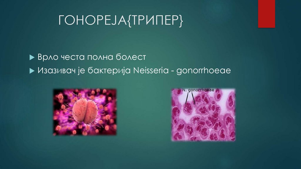            ГОНОРЕЈА{ТРИПЕР}