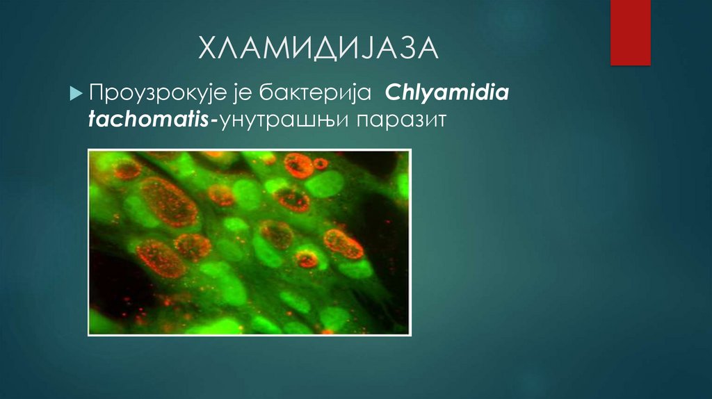                   ХЛАМИДИЈАЗА