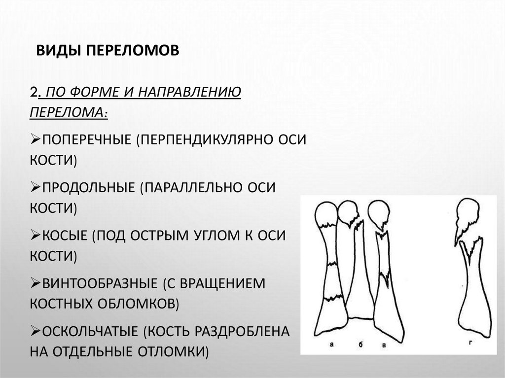 Виды переломов нижних конечностей