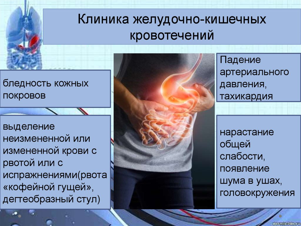 Кровотечение желудка первая помощь