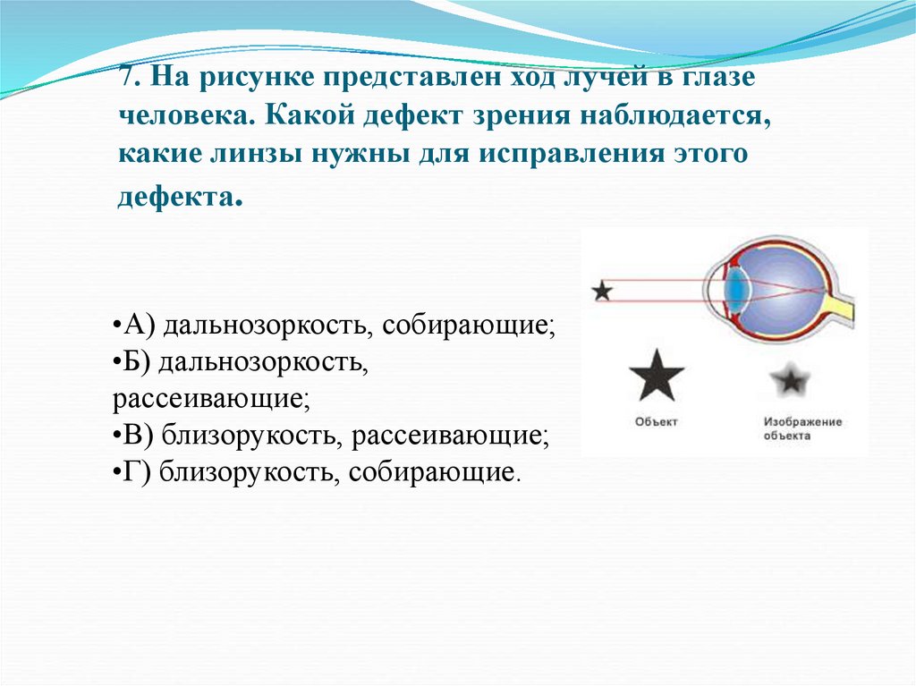 Формирование изображения в нормальном глазе