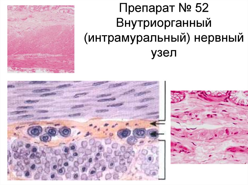 Интрамуральный узел. Интрамуральные ганглии гистология. Интрамуральный ганглий препарат. Интрамуральные ганглии гистология препарат. Интрамуральный ганглий мочевого пузыря.
