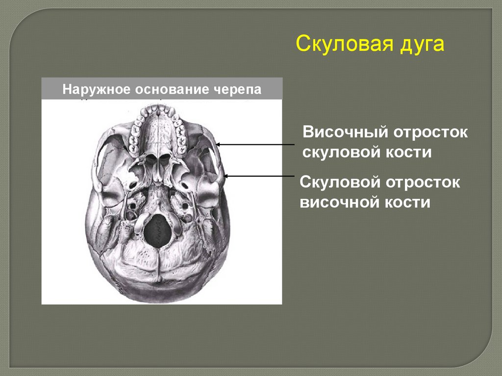 В полости черепа расположен. Хоаны анатомия черепа. Анатомия хоаны основания черепа. Кости основания черепа анатомия. Скуловая дуга анатомия человека.