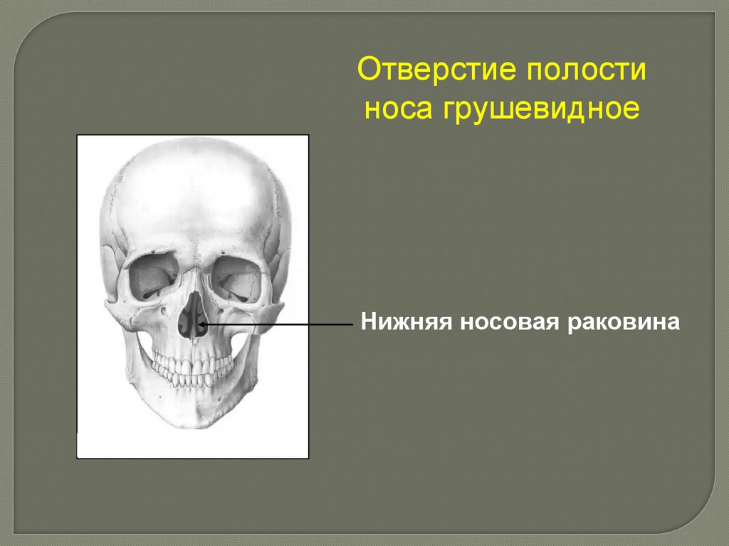 Носовая кость лицевого черепа. Носовые раковины анатомия кости. Носовая кость черепа строение. Костный скелет носовой перегородки. Нижняя носовая кость анатомия.