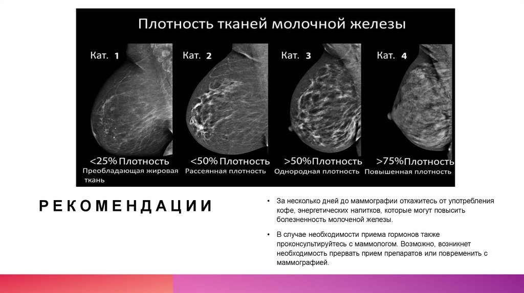 Категории маммографии