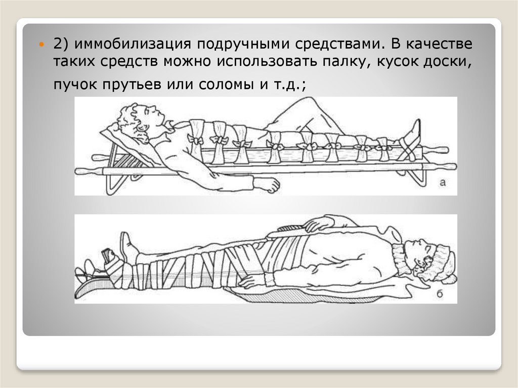 Способы иммобилизации и переноски. Наложение шины Дитерихса алгоритм. Транспортная иммобилизация при переломах. Транспортная иммобилизация при переломе костей таза. Иммобилизация при переломе бедра алгоритм.