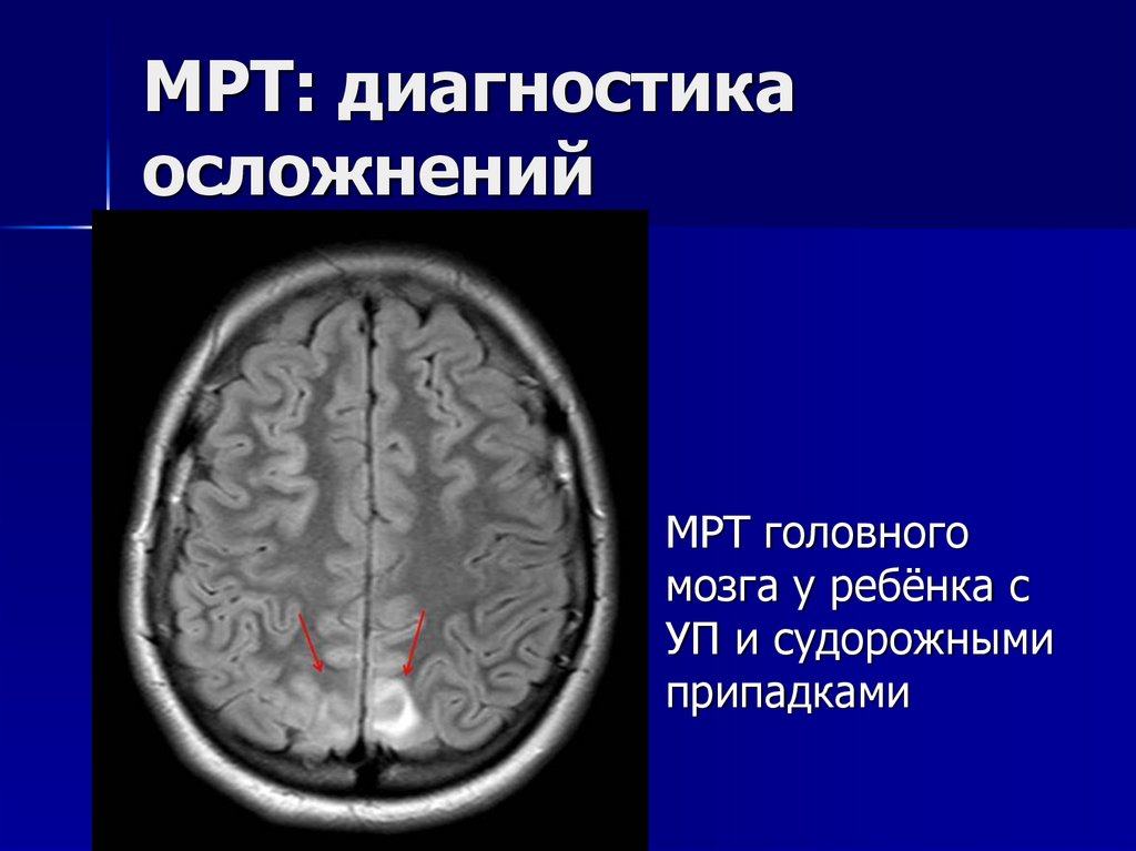 Васкулиты патанатомия презентация