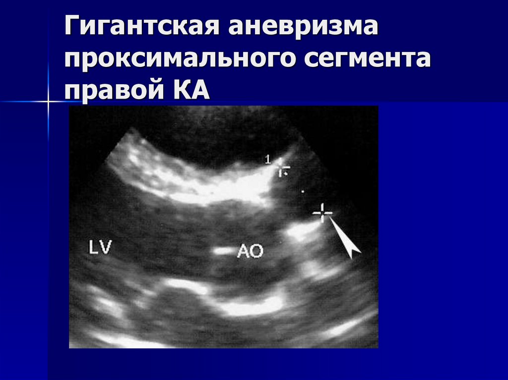 Васкулиты патанатомия презентация