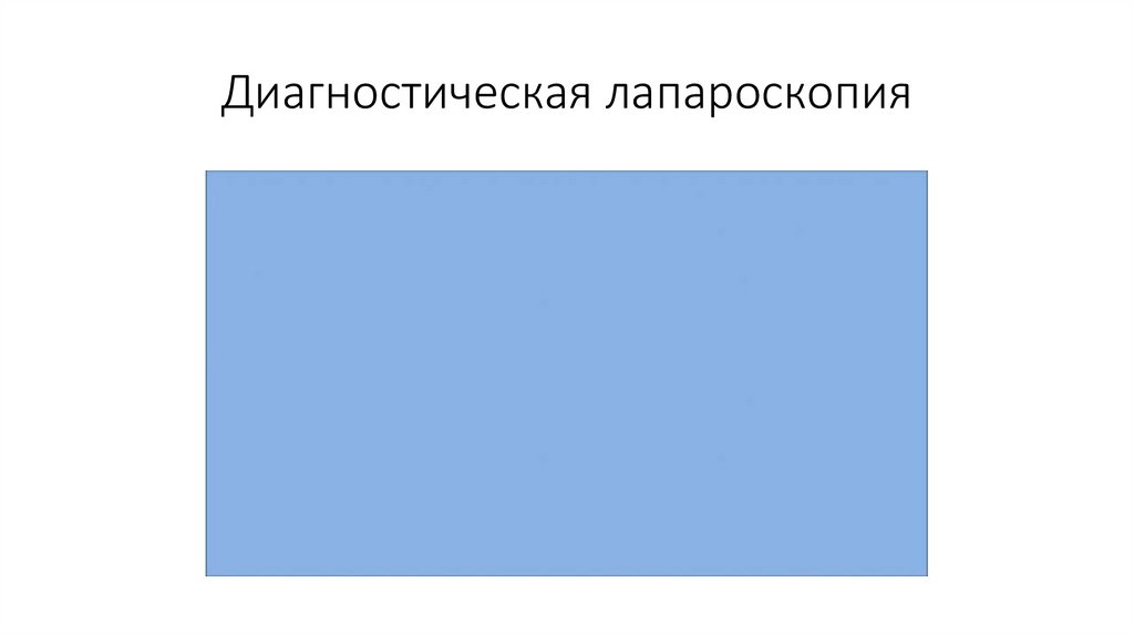 Диагностическая лапароскопия