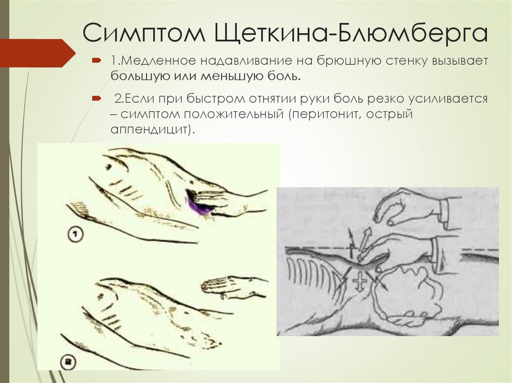 Несостоятельность гастростомы карта вызова