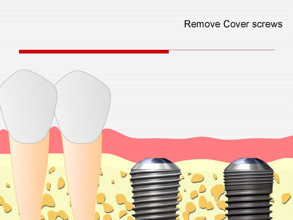 Remove cover перевод