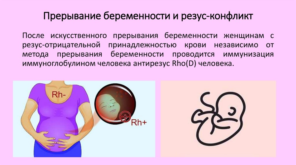 Прерывание беременности нижний