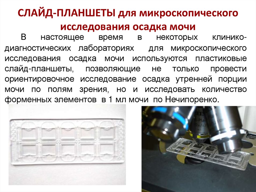 Камера для подсчета клеток в биологических образцах мочи